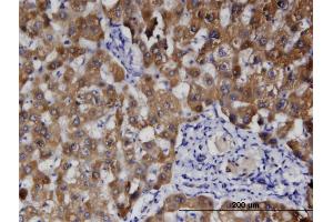 Immunoperoxidase of monoclonal antibody to HFE2 on formalin-fixed paraffin-embedded human liver.