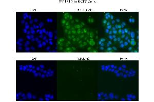 Immunofluorescence (IF) image for anti-Protein Phosphatase 1, Regulatory (Inhibitor) Subunit 10 (PPP1R10) (N-Term) antibody (ABIN2778807)