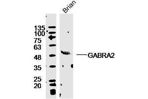 Mouse brain lysates probed with Rabbit Anti-GABRA2/GABA A Receptor alpha 2 Polyclonal Antibody, Unconjugated  ) at 1:300 overnight at 4˚C. (GABRA2 抗体  (AA 185-280))