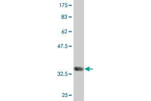 Western Blot detection against Immunogen (33. (ITGB1BP2 抗体  (AA 246-319))