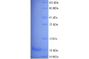 Major Urinary Protein 19 (MUP19) (AA 1-151), (full length) 蛋白