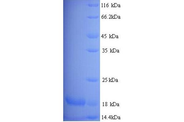 Major Urinary Protein 19 (MUP19) (AA 1-151), (full length) 蛋白