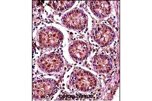 SMC1B Antibody (Center) (ABIN657773 and ABIN2846748) immunohistochemistry analysis in formalin fixed and paraffin embedded human colon tissue followed by peroxidase conjugation of the secondary antibody and DAB staining. (SMC1B 抗体  (AA 737-765))