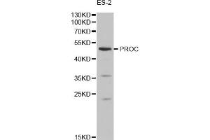Western blot analysis of extracts of ES-2 cells, using PROC antibody (ABIN1874338) at 1:1000 dilution. (PROC 抗体)