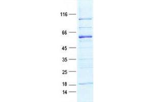 Validation with Western Blot (MYOZ2 Protein (GST tag,His tag))
