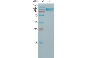 Butyrylcholinesterase (BCHE) (AA 29-602) protein (His tag)
