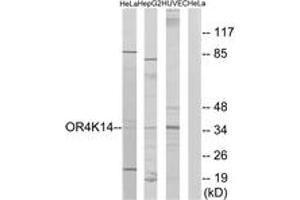 Western blot analysis of extracts from HeLa/HepG2/HuvEc cells, using OR4K14 Antibody. (OR4K14 抗体  (AA 261-310))