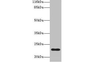 Western blot All lanes: C8G antibody at 2 μg/mL + Human serum Secondary Goat polyclonal to rabbit IgG at 1/10000 dilution Predicted band size: 23 kDa Observed band size: 23 kDa (C8G 抗体  (AA 21-202))