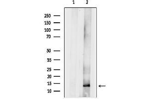 Western blot analysis of lysates from Rat kidney, using RPLP1 Antibody.