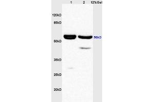 Lane 1: rat liver lysates Lane 2: rat brain lysates probed with Anti phospho-AKT1/2/3 (Tyr315/316/312) Polyclonal Antibody, Unconjugated (ABIN756217) at 1:200 in 4 °C. (AKT 1/2/3 抗体  (pTyr312, pTyr315, pTyr316))