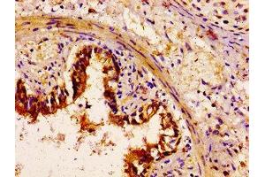 IHC image of ABIN7160568 diluted at 1:100 and staining in paraffin-embedded human lung tissue performed on a Leica BondTM system. (Myosin 抗体  (AA 1058-1195))