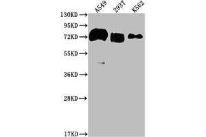 Western Blot Positive WB detected in: A549 whole cell lysate, 293T whole cell lysate, K562 whole cell lysate All lanes: CD55 antibody at 1:2000 Secondary Goat polyclonal to rabbit IgG at 1/50000 dilution Predicted band size: 42, 49, 40, 57, 60 kDa Observed band size: 70 kDa (Recombinant CD55 抗体)