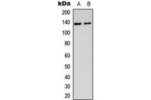 Western blot analysis of DDX8 expression in Jurkat (A), Y79 (B) whole cell lysates. (DHX8 抗体  (Center))