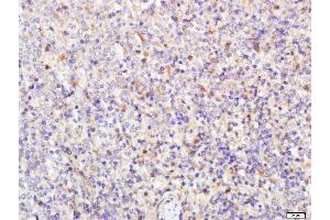Paraformaldehyde-fixed, paraffin embedded rat spleen tissue, Antigen retrieval by boiling in sodium citrate buffer (pH6. (Notch1 抗体  (AA 1754-1800))
