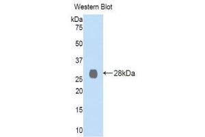 Western Blotting (WB) image for anti-Lysyl Oxidase-Like 2 (LOXL2) (AA 544-751) antibody (ABIN1859686) (LOXL2 抗体  (AA 544-751))