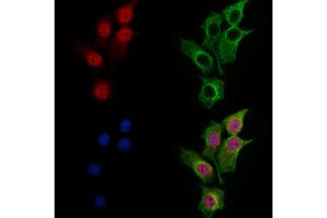 ABIN7094773 and ABIN7098824 staining HepG2 cells by IF/ICC. (MBD4 抗体  (Internal Region))