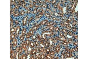 Used in DAB staining on fromalin fixed paraffin- embedded kidney tissue (ACP5 抗体  (AA 29-296))