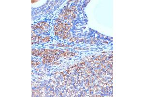 Immunohistochemistry (IHC) image for anti-UDP-GlcNAc:betaGal beta-1,3-N-Acetylglucosaminyltransferase 3 (B3GNT3) (AA 120-240) antibody (ABIN7271204)
