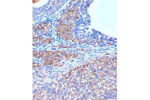 Immunohistochemistry of paraffin-embedded Rat ovary using B3GNT3 Rabbit pAb (ABIN7271204) at dilution of 1:100 (40x lens). (B3GNT3 抗体  (AA 120-240))