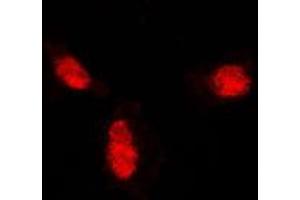 Immunofluorescent analysis of SUMO1 staining in A431 cells. (SUMO1 抗体  (N-Term))