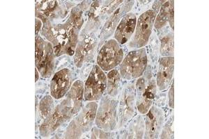 Immunohistochemical staining of human kidney with C14orf101 polyclonal antibody  shows cytoplasmic positivity in cells of renal tubules at 1:50-1:200 dilution. (C14orf101 抗体)