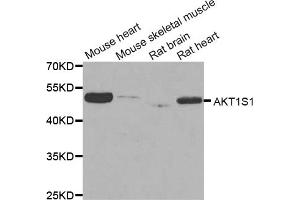 Western blot analysis of extracts of various cell lines, using AKT1S1 antibody (ABIN5973672) at 1/1000 dilution. (PRAS40 抗体)