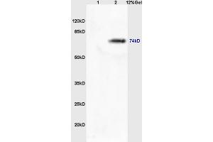 Lane 1: mouse lung lysates Lane 2: mouse brain lysates probed with Rabbit Anti-MASP2 Polyclonal Antibody, Unconjugated (ABIN676223) at 1:200 in 4 °C. (MASP2 抗体  (AA 351-450))