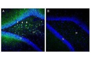 Expression of SLC25A12 in rat hippocampus. (SLC25A12 抗体  (Intracellular, N-Term))