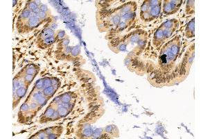 ABIN6257553 and ABIN6274359 at 1/100 staining Rat stomach tissue by IHC-P. (WTAP 抗体  (C-Term))