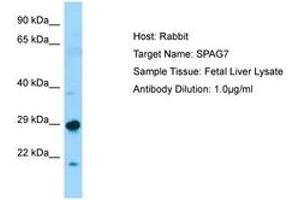 Image no. 1 for anti-Sperm Associated Antigen 7 (SPAG7) (N-Term) antibody (ABIN6750073) (SPAG7 抗体  (N-Term))