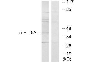 Western blot analysis of extracts from HeLa cells, using 5-HT-5A antibody. (Serotonin Receptor 5A 抗体)
