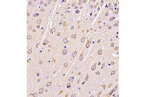 Immunohistochemistry of paraffin embedded rat brain using CRMP3 (ABIN7073734) at dilution of 1:650 (400x lens)