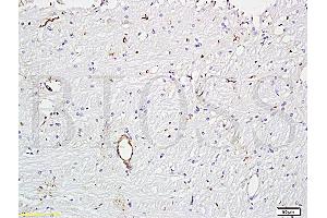 Formalin-fixed and paraffin embedded rat brain tissue (ABIN670506) at 1:300 followed by conjugation to the secondary antibody and DAB staining. (VWF 抗体  (AA 701-800))