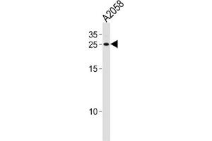 Western Blotting (WB) image for anti-Adenine Phosphoribosyltransferase (APRT) antibody (ABIN3001698) (APRT 抗体)