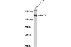 Western blot analysis of extracts of mouse testis, using ERCC8 Antibody (ABIN6134311, ABIN6140278, ABIN6140280 and ABIN6222611) at 1:1000 dilution. (ERCC8 抗体  (C-Term))