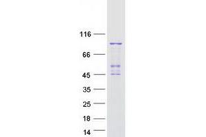Western Blotting (WB) image for Phospholipase A2, Group VI (Cytosolic, Calcium-Independent) (PLA2G6) (Transcript Variant 1) protein (Myc-DYKDDDDK Tag) (ABIN2729083)