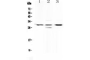 Western blot analysis of MED8 using anti-MED8 antibody . (MED8 抗体  (AA 1-195))