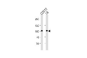 Western blot analysis of lysates from C2C12, L6 cell line (from left to right), using Musk Antibody (ABIN6242455 and ABIN6577083). (MUSK 抗体  (AA 600-860))