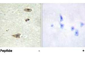 Immunohistochemical analysis of paraffin-embedded human brain tissue using GRK1 polyclonal antibody . (GRK1 抗体)