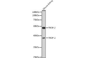 Western blot analysis of extracts of Mouse kidney, using TROP-2 antibody (ABIN7271104) at 1:1000 dilution. (TACSTD2 抗体  (AA 27-270))