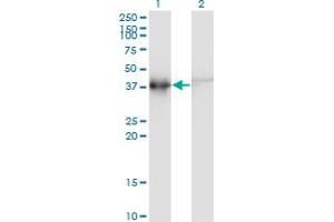 Western Blot analysis of ACTRT2 expression in transfected 293T cell line by ACTRT2 monoclonal antibody (M03), clone 2E10. (ACTRT2 抗体  (AA 209-299))
