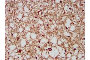 IHC image of ABIN7165184 diluted at 1:200 and staining in paraffin-embedded human brain tissue performed on a Leica BondTM system.