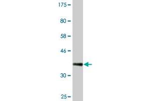 Western Blot detection against Immunogen (36. (SRPK1 抗体  (AA 371-470))