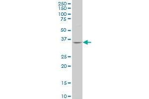 PQBP1 polyclonal antibody (A01), Lot # 060707JCS1 Western Blot analysis of PQBP1 expression in MES-SA/Dx5 . (PQBP1 抗体  (AA 184-265))