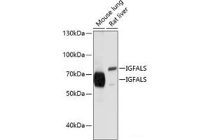 Western blot analysis of extracts of various cell lines using IGFALS Polyclonal Antibody at dilution of 1:1000. (IGFALS 抗体)