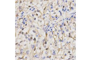 Immunohistochemistry (IHC) image for anti-Protein Phosphatase 2A Activator, Regulatory Subunit 4 (PPP2R4) (AA 1-323) antibody (ABIN6219052) (PPP2R4 抗体  (AA 1-323))