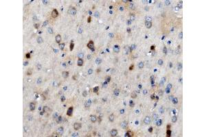 IHC analysis of MAP3K8 using anti-MAP3K8 antibody (ABIN4886663). (MAP3K8 抗体  (AA 9-193))