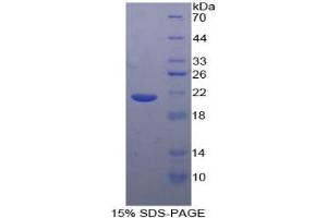 SDS-PAGE of Protein Standard from the Kit (Highly purified E. (TNF alpha ELISA 试剂盒)