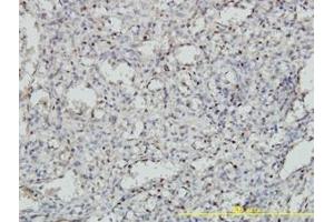 Image no. 1 for anti-Meis Homeobox 2 (MEIS2) (AA 1-382) antibody (ABIN598810) (MEIS2 抗体  (AA 1-382))