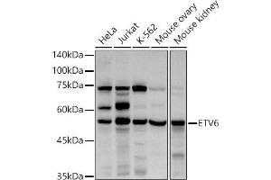 Western blot analysis of extracts of various cell lines, using ETV6 antibody (ABIN3022302, ABIN3022303, ABIN3022304, ABIN1512878 and ABIN6218719) at 1:1000 dilution. (ETV6 抗体  (AA 1-300))